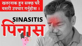 Home treatment of Sinusitis || Pinasako Upachar || Pinas ||