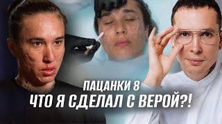 Что я сделал с Верой?! ПАЦАНКИ | Огромные рубцы постакне #пацанки8