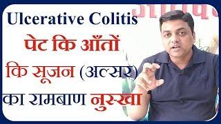 Ulcerative Colitis पेट में सूजन का रामबाण इलाज