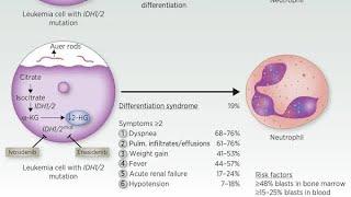 Differentiation syndrome caused by ATRA therapy in APML