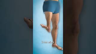 The Surgery That Turns Legs Around Surgeon Reacts
