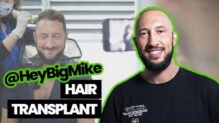 Hair Transplant Story of Famous YouTuber Mike Majlak | HEYBIGMIKE |  Smile Hair Clinic