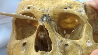 Persian Anatomy, Head & Neck آناتومی سر و گردن بزبان فارسی Zygomatic bone