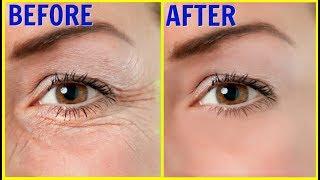 Only 3 days, how to remove "Wrinkles" | How to get rid of wrinkles