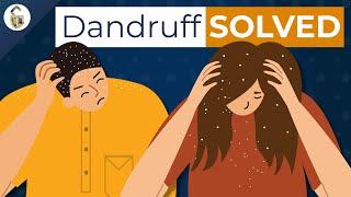 Why We Get Dandruff (and how to get rid of it)