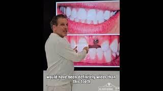 The Art of Natural-Looking Tooth Replacement | Dr. Joseph Goodman