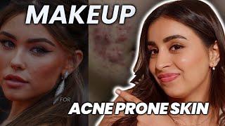 Flawless & Acne-Free: Dr. Riya's Ultimate Makeup Guide for Acne Prone Skin !