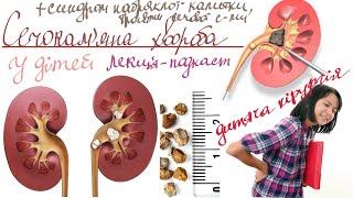 Сечокам'яна хвороба у дітей | Травми сечової системи | Синдром набряклої калитки лекція (подкаст)