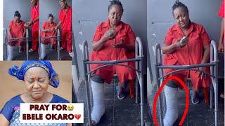 Pray For Actress Ebele Okaro As This Happened To Her, Sad VideoIn The Hospital Of Leg Injury.