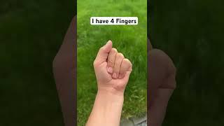 I have 4 Fingers #shorts #funny #finger #nikitos