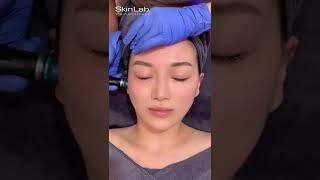 Signature HydraFacial