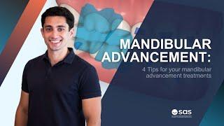 4 Tips for your mandibular advancement treatments | SAS