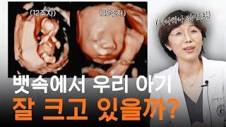 (실제상황) 자궁 내 태아 성장과정 초음파 영상, 산부인과 의사가 직접 보여드림