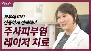 안면홍조, 주사피부염, 레이저 치료 필요한가요?