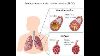 Ce este BPOC-ul și care sunt principalele simptome?