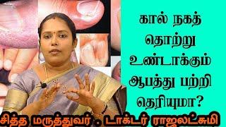 நகச்சொத்தை பிரச்சனைக்கு இயற்கை முறையில் முழு தீர்வு | Nagasothai Natural Treatment | Dr.Rajalakshmi