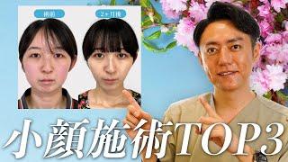 【顔顔整形】プロがガチでおすすめする小顔施術TOP3！！