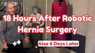 Inguinal Hernia Surgery Recovery - My Quick Return to Work After Robotic Hernia Surgery!