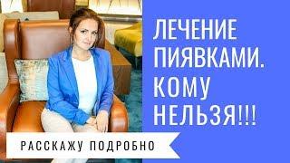 Основные противопоказания для лечения пиявками.