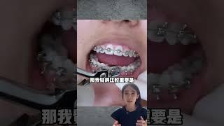 這集看起來很好吃#牙套族食物禁忌#牙齒矯正