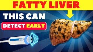 The Best 3 Tests to Detect Fatty Liver Early | Fatty Liver #fattyliver #health