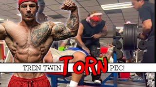 Hate To Say I Told You So... || Tren Twins Mikey Torn Pec