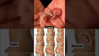 13 week fetal movement #baby #movement