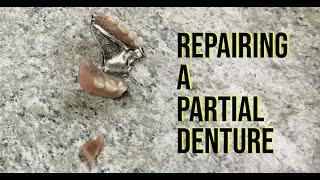 Repairing/Fixing A Partial Denture - Parisien Denture Clinic, Windsor, Ontario, Canada