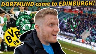  THE LAST SCOTTISH TEAM LEFT IN EUROPE! Hibernian v Dortmund