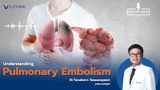 Pulmonary Embolism l Vejthani Hospital