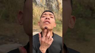 ASMR AMERICA'S How I Cured a Bug Bite with Yogurt in the Wild | Survival Hacks#3086