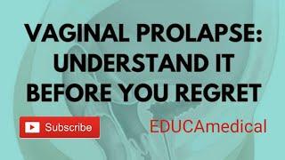 Vaginal Prolapse: Types, Causes, Symptoms, Stages, Diagnosis and Treatment