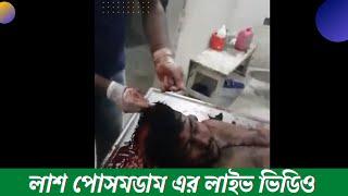 দেখুন কিভাবে লাশ ময়নাতদন্ত করা হয়   লাশ কিভাবে কাটা হয়   Steps of Autopsy Dissection   PostMortem