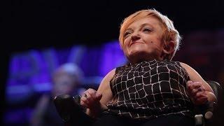 史黛拉•杨(Stella Young): 我不是你们的励志榜样，谢谢。