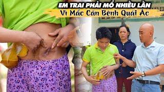 CĂN BỆNH QUÁI ÁC VIÊM HẬU MÔN ,6 NĂM LIỀN EM TRAI PHẢI CHỐNG CHỌI VỚI CĂN BỆNH NÀY