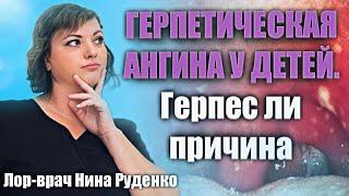 Герпетическая ангина у детей