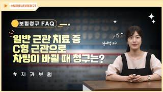 [보험청구 FAQ] ep 19. 일반 근관으로 치료 중 C형근관으로 차팅이 바뀔 때, 청구는?