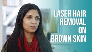 Best Laser Hair Removal London - Shumaila's - Review - Alisha - Female #laserhairremoval