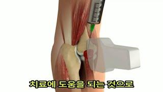 PRP의 마법: 성장인자의 힘을 풀다 Unlocking the Power of PRP: Growth Factors Revealed