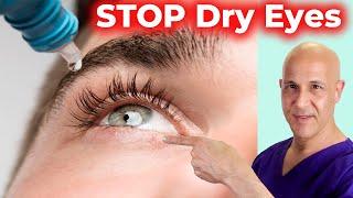 Soothe and Heal DRY EYES Naturally!  Dr. Mandell