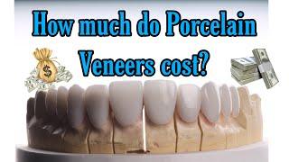 How much do Porcelain Veneers cost?