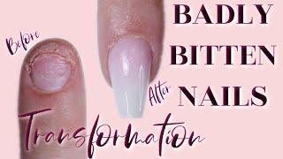 HOW TO APPLY TIPS ON A BITTEN NAIL | DOING MY NAILS USING MY NON DOMINANT HAND