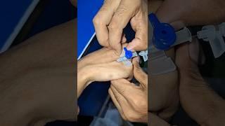 iv cannula proceed #part16