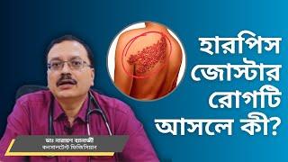 হারপিস জোস্টার কী? এই রোগেরউৎস, উপসর্গ এবং প্রতিকার । ডাঃ নারায়ণ ব্যানার্জী । Prescription Plus