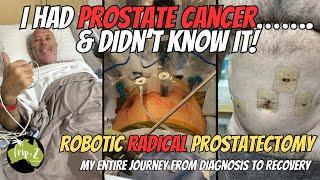 PROSTATE CANCER - My full journey from Diagnosis to Recovery - Ep 69