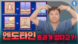 엔도타인이 효과가 없다고?