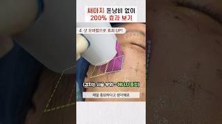 써마지 받기 전 필수 시청! 돈낭비 없이 효과 200% 보는 법 | 써마지 잘하는 의사 #눈가주름 #입가주름 #탄력 #탄력관리 #thermage #모즈클리닉 #modsclinic