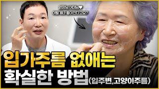 입가주름, 입술주름 없애는 방법. 40대 이상 강력추천 (레디어스 부스터)