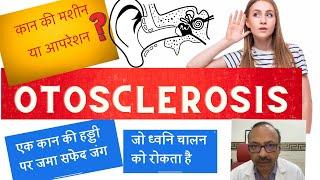 ओटोस्क्लरोसिस में क्या कान का ऑपरेशन करवाए या कान की मशीन लें ? Otosclerosis- Hearing Aid vs Surgery