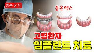 나이가 많아도 가능한 임플란트 ft. 올온엑스